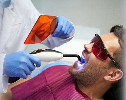 What to Eat and What to Avoid After Getting a Dental Filling 