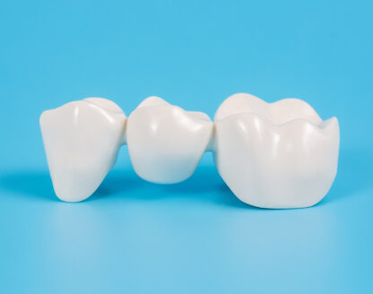 Maryland Dental Bridges vs. Traditional Bridges 
