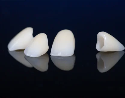 Dentist in Ellicott City 