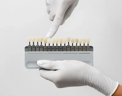 Dental veneers in Ellicott City 