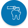 Placement of Filling Material