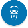 Porcelain-Fused-to-Metal Crowns