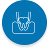 Teeth Whitening for Brighter Smiles