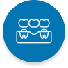 Traditional Dental Bridge